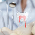 Tips For Root Canals In Noblesville Indiana