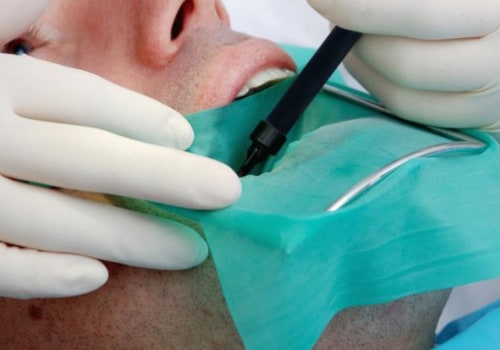 Where does a root canal hurt?